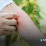 ¿Por qué te siguen los zancudos? ¡Esta es la razón!