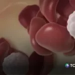 ¡Esto debes saber sobre la hemofilia!