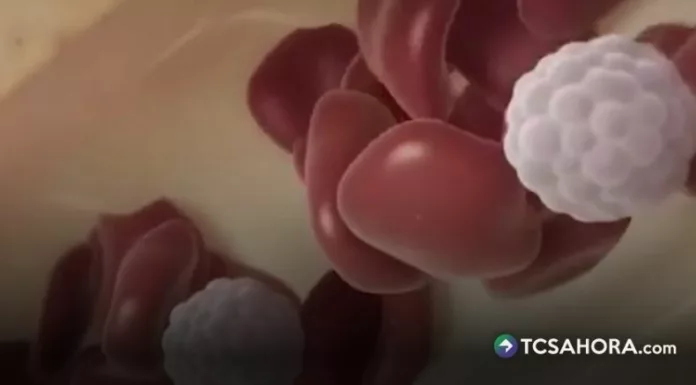 Aunque la hemofilia no tiene cura, existen tratamientos que ayudan a controlar la enfermedad y reducir el riesgo de complicaciones.