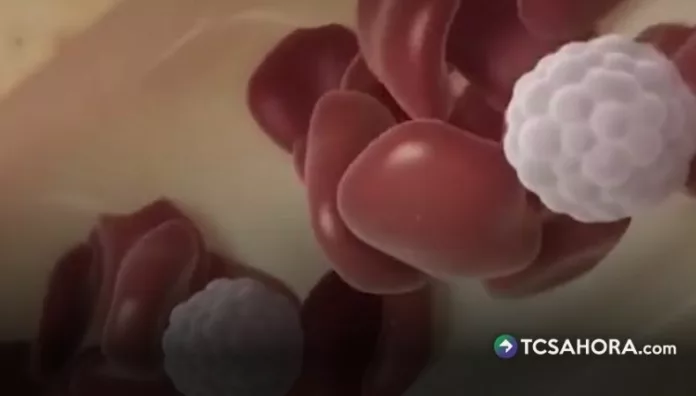 Aunque la hemofilia no tiene cura, existen tratamientos que ayudan a controlar la enfermedad y reducir el riesgo de complicaciones.