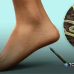 El tétano sigue siendo una amenaza a nivel mundial
